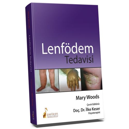 Lenfödem Tedavisi - Mary Woods, İlke Keser